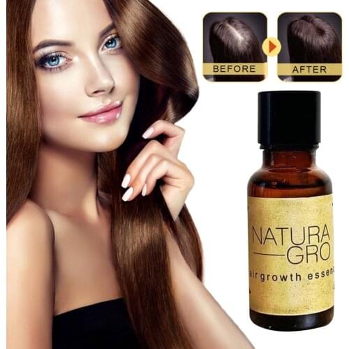 Best Sale 20ml Ginger Extract Dense Hair Fast Sunburst Hair Growth Essence Restoration Hair Loss Liquid Serum Hair Care Oil #E
