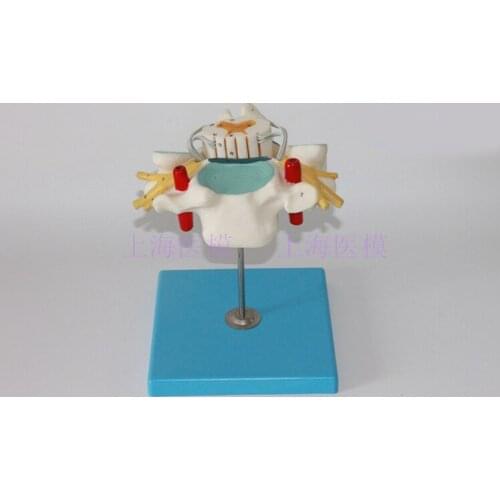 Cervical spinal nerves model spinal cord and spinal dural amplification structure model cervical vertebral artery