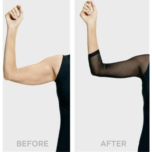 Arm Shaper Women Both Side Plus Size Mesh Seamless Silm Shapewear Crop Top Slimming Upper Shirt Blouses Black White