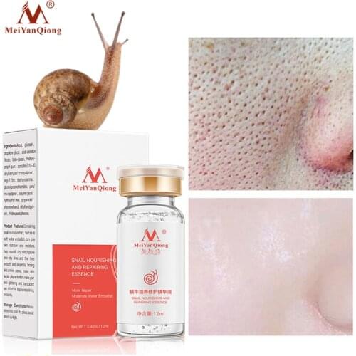 Snail Face Serum hyaluronic acid Moisturizing Essence liquid Shrink pores Whitening Anti-wrinkle Anti-aging Treatment Acne Skin