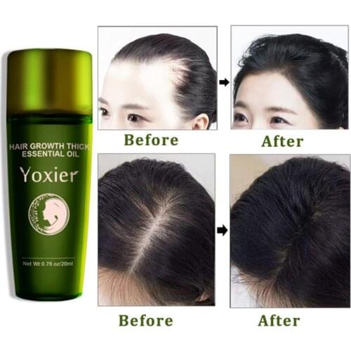 Ginger Hair Growth Essential Oil Hair Growth Serum Hair Nursing Multi-functional Hair Loss Liquid Hair Care For Men Women TSLM2