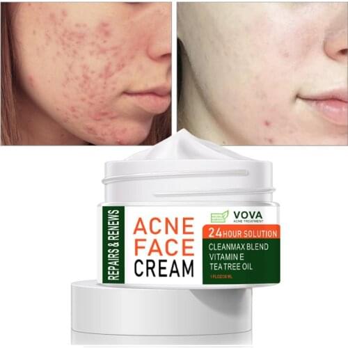 VOVA Acne Cream Anti-Acne Treatment Tea Tree Oil Vitamin E Whitening Face Cream Moisturizing Soothing Acne Remover Skin Care 30g