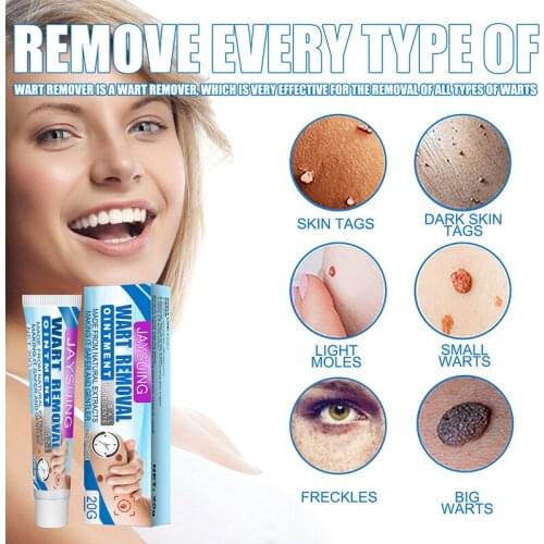 Wart Tag Remover Cream Warts Remover Safe Painless Skin Tags Removal Ointment Wart Treatment Cream For All Skins TSLM1