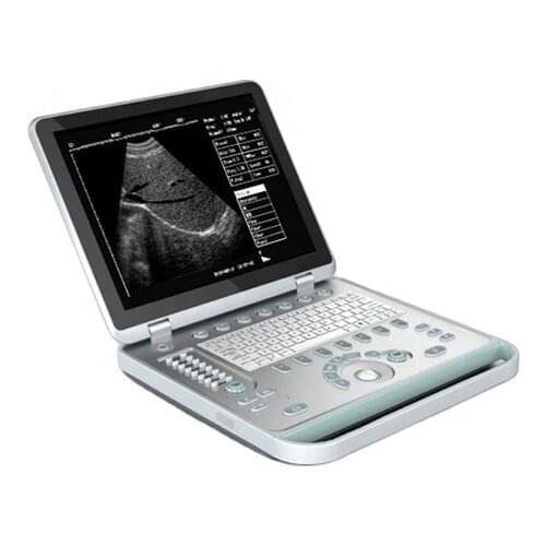 Wireless portable handheld 3d laptop ultrasound 20mhz liner scan compatable ultrasound scan head digital b-ultrasound scanner