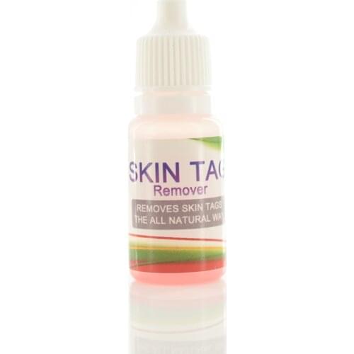 Black Dots Mole Wart Skin Tag Remover 12 Hours Tu Kill Liquid Medical Foot Corn Removal Foot Care Mole Skin Tag Removal Solution
