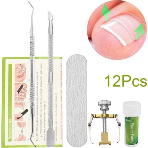 24pcs /Set Ingrown Toenail Correction Tool Set Ingrown Toe Nail Pedicure Elastic Patch Straightening Clip Brace Bunion Corrector