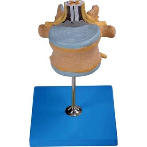 Lumbar Vertebra with Spinal Cord and Cauda Equina Nerve 3D Anatomical Teaching Model