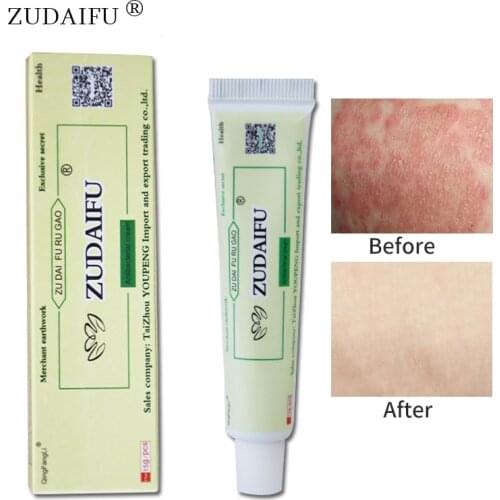 3 Boxes Zudaifu Skin Psoriasis Cream Dermatitis Eczematoid Eczema Ointment Treatment Psoriasis Skin Care Cream
