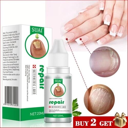 Nail Fungal Treatment Feet Care Essence Nail Foot Whitening Toe Nail Fungus Removal Gel Anti Infection Paronychia Onychomycosis