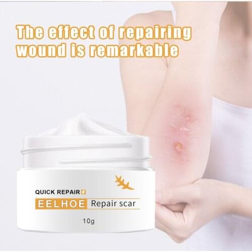 Repair Scar Cream Skin Care Body Cream Stretch Mark Repair Cream Scar Removal Scars Line Treatment Wound Creams Body Skin Care