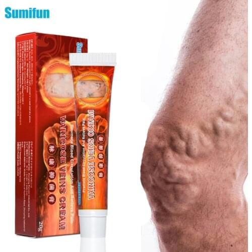 Sumifun 1Pcs Varicose Veins Cream Cure Varicosity Angiitis Remedy Pain Relief Ointment Herbal Medical Plaster Skin Care K10004