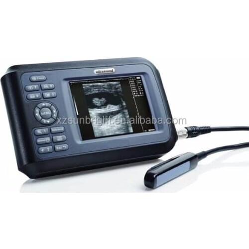 China medical portable SUN-808F home baby ultrasound machine for pregnancy abdomen