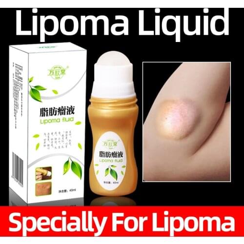 40ml Fat Mass Lipoma Remove Spray Multiple Chinese Herbal Medically Anti-Tumor Care liquid Health Care Product