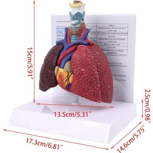 Life Size Human Lung Model Anatomical Respiratory System Anatomy Teaching Tool Dropship
