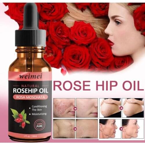 Organic Rosehip Seed Oil Add Water Moisturizing Oil Control Brighten Firm Skin Color Anti-Dry Anti-Aging Face Care Essence Oils