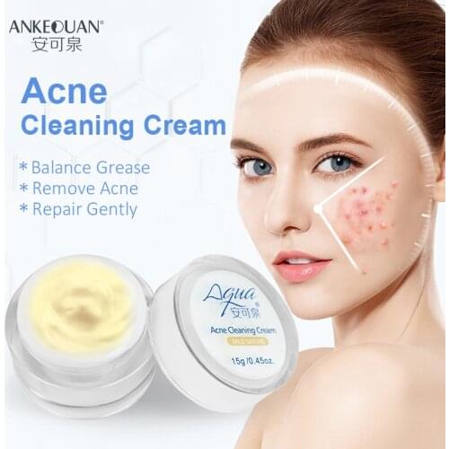 Effective Acne Removal Cream Acne Treatment Fade Acne Spots Oil Control Shrink Pores Whitening Moisturizing Acne Cream Skin Care