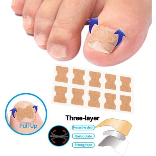 30pcs Toenail Patch Correction Stickers Pedicure Tool Non-Glue Toenail Patch Toe Nail Treatment Foot Care Sticker for Women