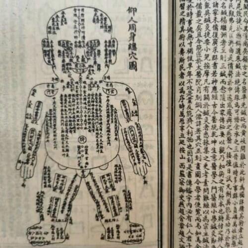 Illustrated Book of Acupuncture in Ancient China,12 books/set,best collection & adornment