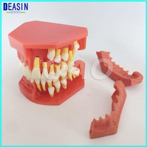 Children 's deciduous teeth replacement model, milk permanent teeth alternately display model oral communication model