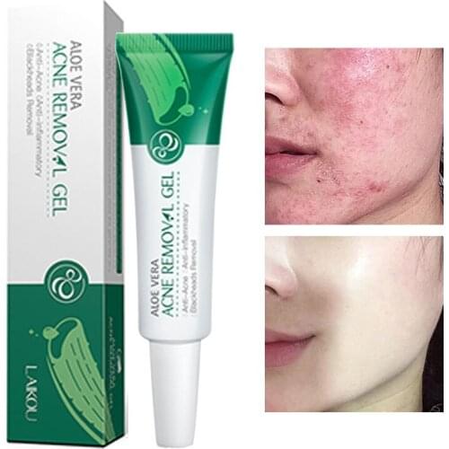 Remove Acne Gel Nourish Moisturizing Acne Treatment Anti-Aging Repair Firming Lifting Oil-Control Aloe Vera Beauty Skin Care 20g