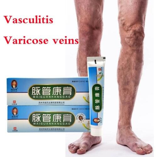 1 Pc Varicose Veins Treatment Ointment Vasculitis Phlebitis Spider Veins Pain Varicosity Angiitis Remedy Removal Herbal Cream
