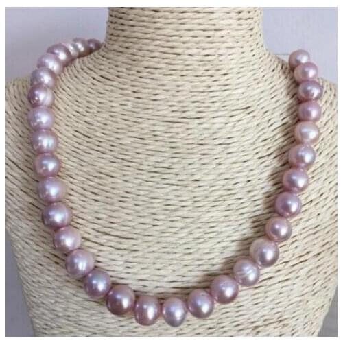 9-10mm south sea baroque lavender white pearl necklace 18