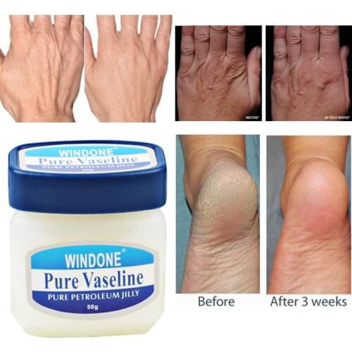Traditional Chinese 50g Oil Anti-Drying Crack Foot Cream Heel Cracked Repair Cream Removal Dead Skin Hand Feet Care