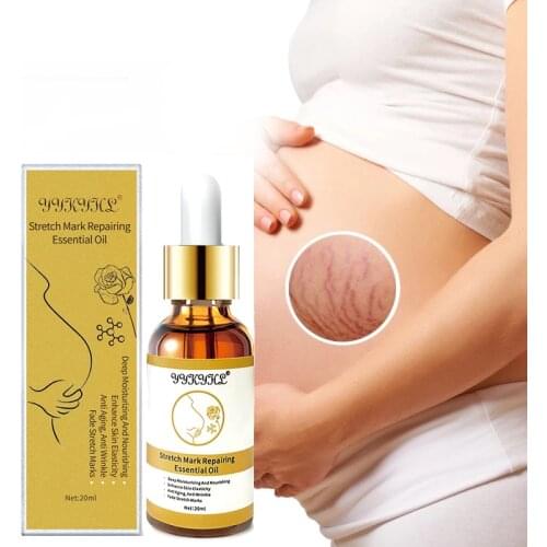 Stretch Marks Remover Essential Oil Skin Care Treatment Cream For Stretch Mark Removal Maternity Slackline For Pregnant Oils