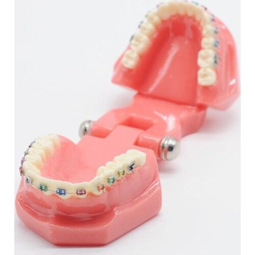 Dentist Orthodontic Mallocclusion Teeth Model With Bracket Archwire Buccal Tube For Dental Lab Supplies