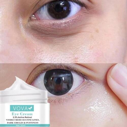 Remove Eye bags Cream Retinol Cream Anti Puffiness Circles fades Skin wrinkles aging Delays Firming Gel Brighten Dark K6I4