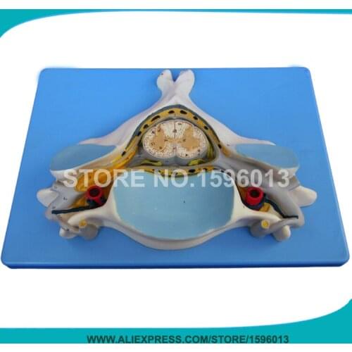 HOT Fifth Cervical Vertebra with Spinal Cord and Nerve, Vertebrae Model