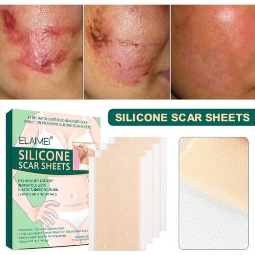 Scar Sheets Silicone Scar Removal Sheets Soften and Flatten Scars of Surgery Burn Scald Acne Scar Reusable Scar Sheets