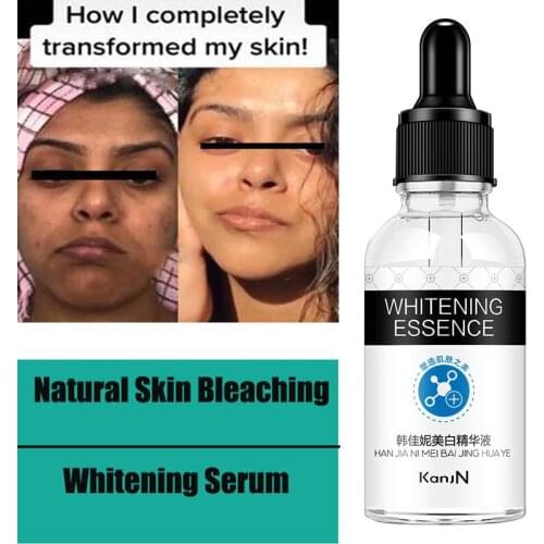 30ml Strong Natural Skin Bleaching Skin Lightening Cream Lotion Skin Whitening Lotion Serum