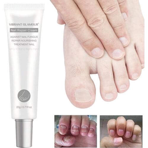 1Pcs Nail Repair Cream Antibacterial Repair Treatment Onychomycosis Paronychia Nails Toenail Fungus Relief Body Skin Care 20g