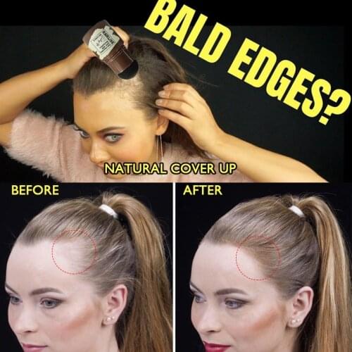 Средства от выпадения волос ONEVAN China At AliExpress