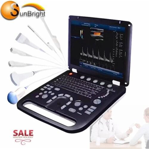 Full Digital Portable Ultrasound Diagnostic System 4D echo color Doppler ultrasound Sun-906B