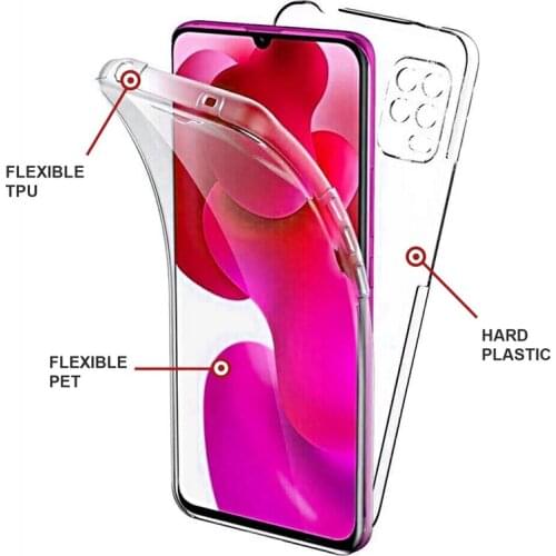 NBYST Phone Cases Xiaomi Mi 10 5G