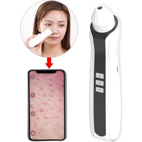 USB Rechargeable Visual Blackhead Remover Blackhead Remover Vacuum with camera Pore Acne Cleaner Face Nose Cleasn Pimple Removal