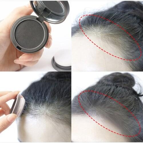 SUNAMCOME Hair Loss Remedies