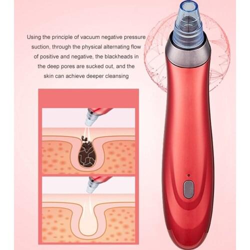 Blackhead Remover Electric Facial Pore Needles Acne Black Spot Cleaning Machine Facial Diamond Beauty Clean Skin Tool