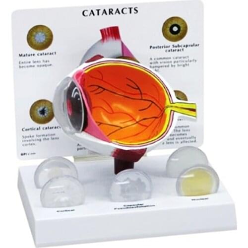 4X Human Pvc Eye Cataract Anatomy Medical Teaching Model
