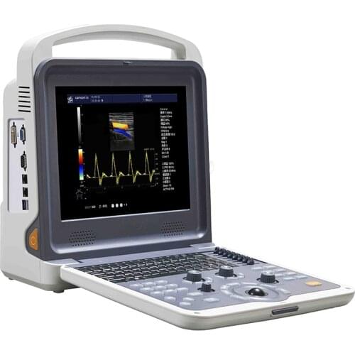 YSB-K2000 Hottest model high resolution 3D 4D color doppler portable ultrasound machines laptop ultrasonic scanner for sale