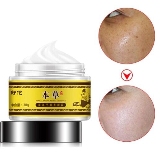 Moisturizer Face Cream Anti Aging Wrinkles Acne Hyaluronic Acid Herb Whitening Cream can CSV