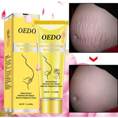 Rose Remove Stretch Marks Cream Anti Wrinkle Anti Aging Maternity Skin Repair Remove Pregnancy Scars Treatment Body 40g TSLM2