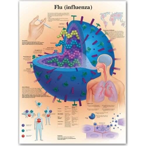 WANGART Flu Influenza Chart Art Poster Print Body Map Canvas Wall Pictures for Medical Education Home Decor