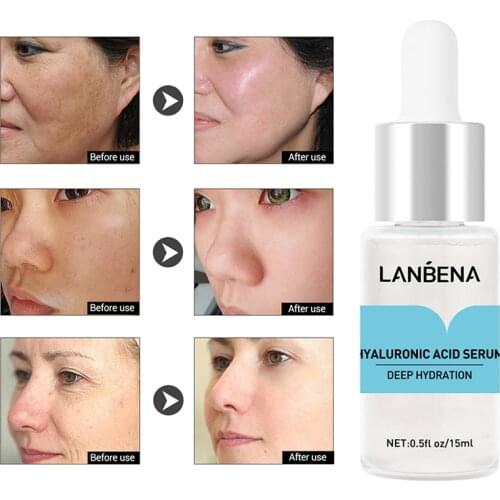 LANBENA Hyaluronic Acid Moisturizing Serum Skin Care Winkles Wrinkle Cream Face Cream Acne Treatment TSLM1