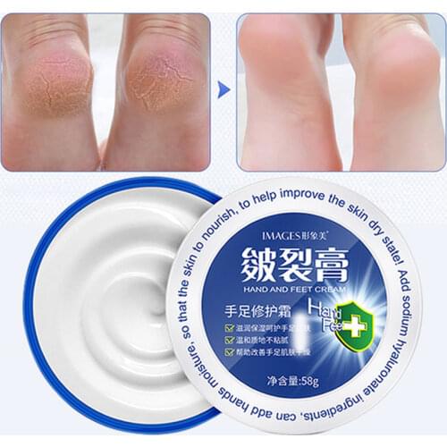 Hand And Foot Repair Cream Traditional Chinese Oil Anti-Drying Glycerin Allantoin To Reduce dry Lines Moisturizer Hand Feet Care