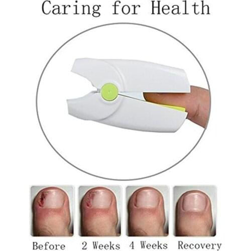 Rechargeable Low Level Laser Therapy Device Lllt No Pain Finger Nail Fungus Toe Nail Disease Onychomycosis Infections Treatment