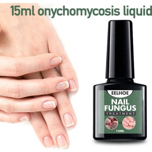 Fungal Nail Treatment Serum Nail Foot Nail Fungus Removal Fungal Onychomycosis Nail Gel Anti Repair Infection Repair Nail G6Q7