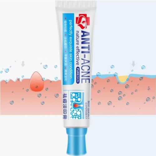Traditional Chinese medicine Acne Treatment Shrink Pores Spots Gel Bleaching Creams Whitening Moisturizing Face Cream